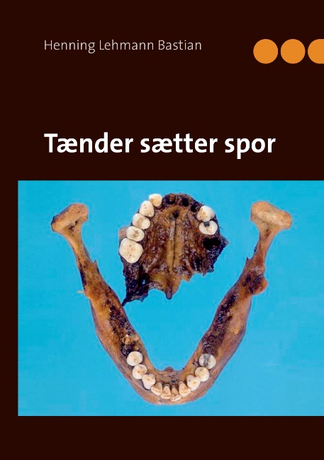 Tænder sætter spor