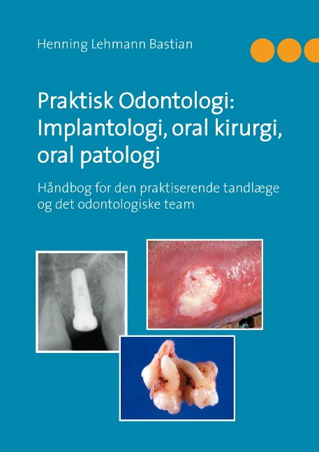 Praktisk Odontologi: Implantologi